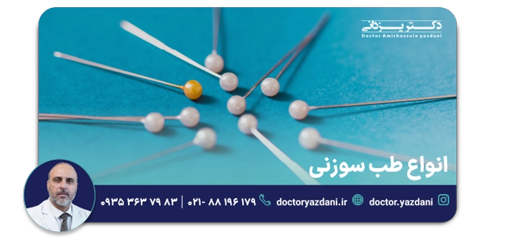 انواع طب سوزنی